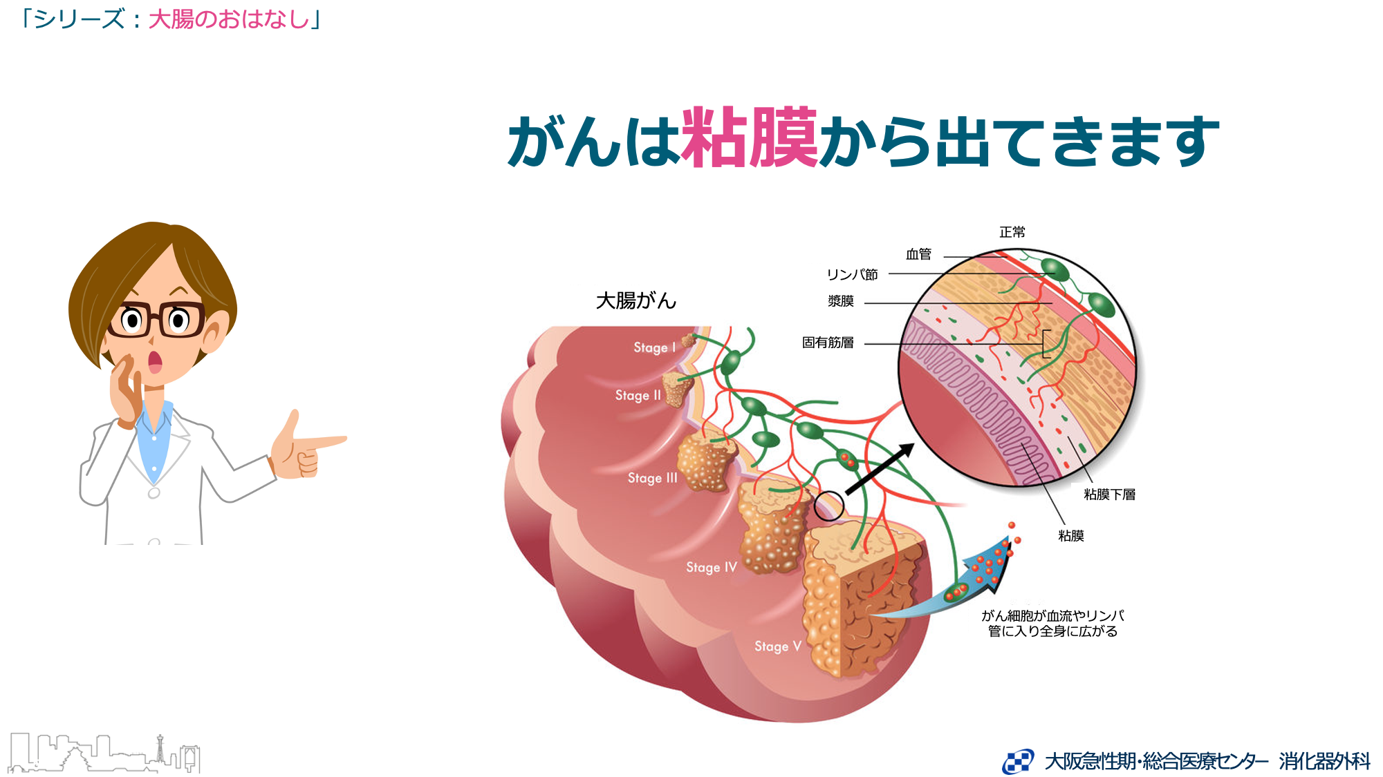 静脈炎とは何ですか?